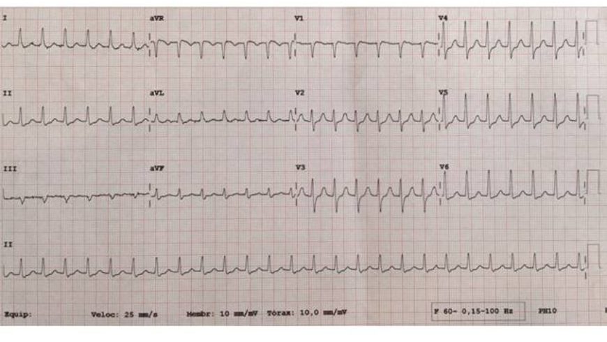 Desafio de ECG – Rio de Janeiro