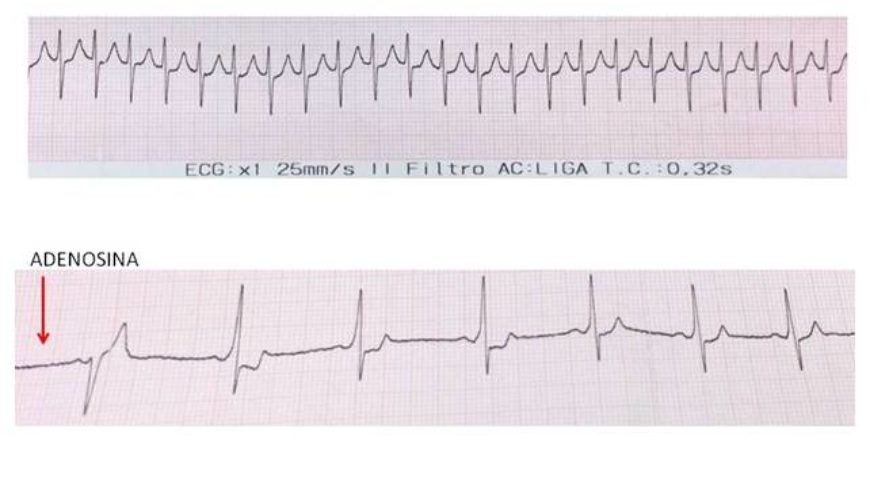Desafio de ECG – Cary (EUA)