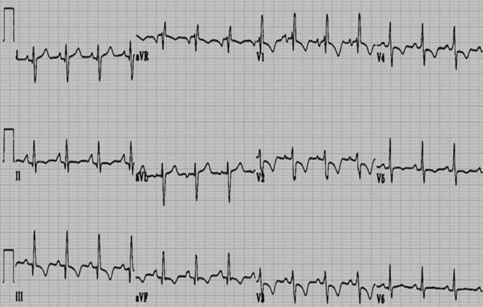Desafio de ECG – Campinas