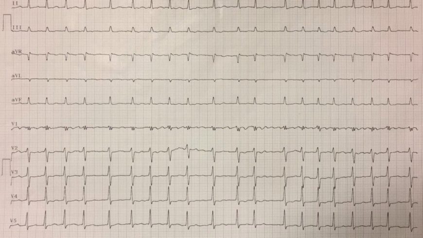 Desafio de ECG – São Paulo
