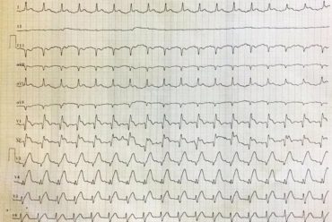 Desafio de ECG – Sorocaba