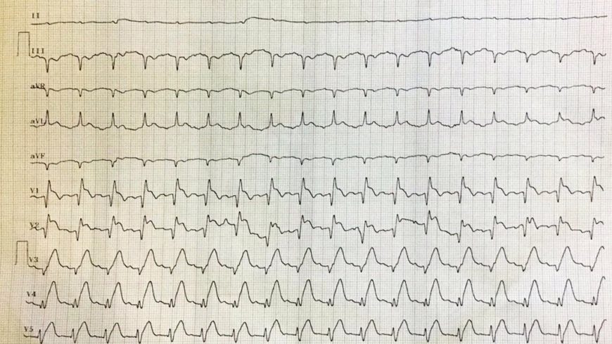 Desafio de ECG – Sorocaba