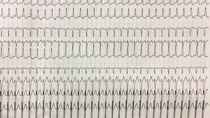 Desafio de ECG – Vitória