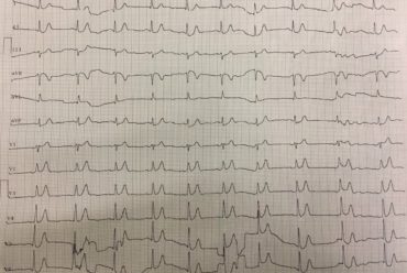 Desafio de ECG – Santo André