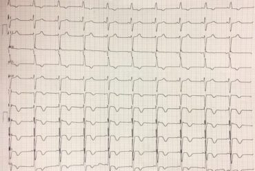Desafio de ECG – Jundiaí