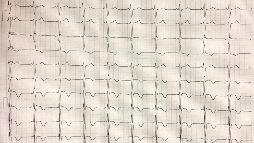 Desafio de ECG – Jundiaí