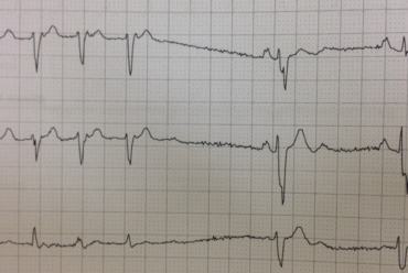 Desafio de ECG – Londres