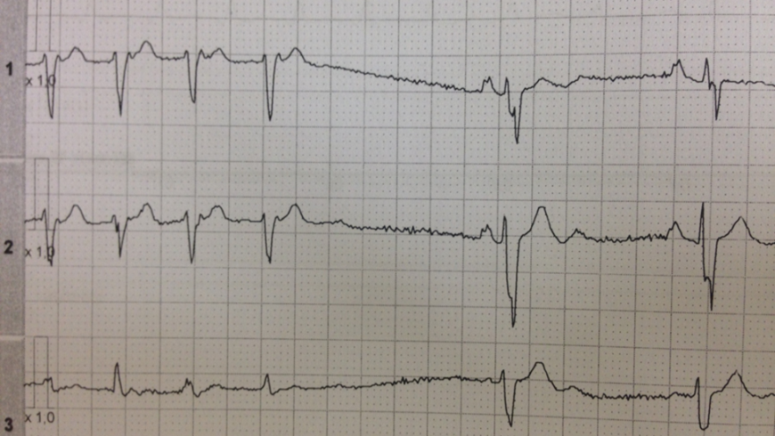 Desafio de ECG – Londres