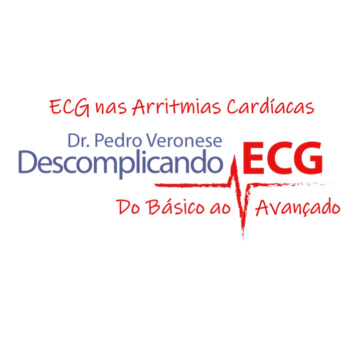 Já está no ar o novo curso de ECG nas Arritmias Cardíacas